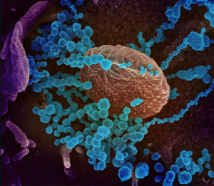 Researchers launch pilot study to set up COVID-19 early warning system