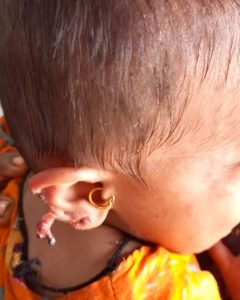 Timely Action by Ibrahim Hyderi Police: 8-Month-Old Kidnapped Baby Recovered Safely